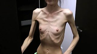 Half-starved Denisa posing put hither up has ribs mincing